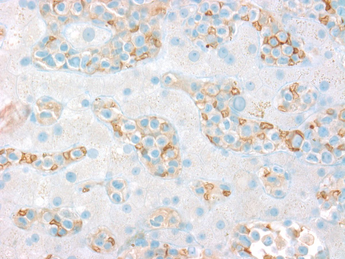 Liver: Glycophorin positive erythroblasts